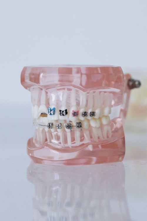 Soft foods recommended after oral surgery by a dental clinic in Aurora